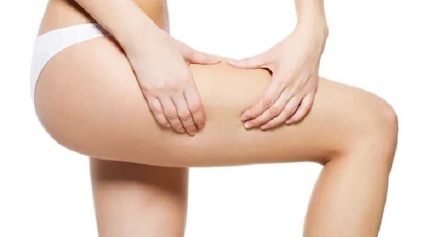 Te traemos los mejores consejos para eliminar la celulitis facilmente. (Foto: Freepik)